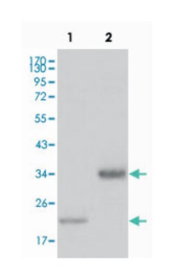 LPA, Mouse, Clone: 8F6A9, 8H5C5, Abnova 100&mu;L; Unlabeled:Antibodies,