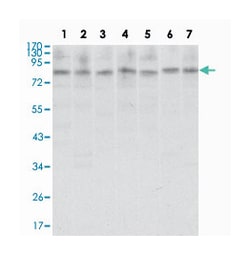 CTCF, Mouse, Clone: 1D11, Abnova 100&mu;L; Unlabeled:Antibodies, Monoclonal