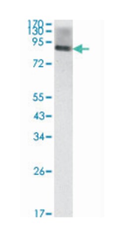ICAM1, Mouse, Clone: 6G12, Abnova 100 &mu;L | Buy Online | Abnova Corporation | Fisher Scientific