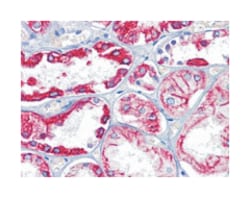 KRT8, Mouse, Clone: 8A5D12, Abnova 100 &mu;L | Buy Online | Abnova | Fisher Scientific