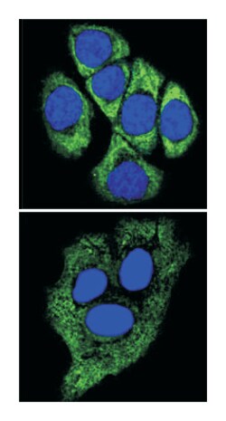 KRT8, Mouse, Clone: 8A5D12, Abnova 100 &mu;L | Buy Online | Abnova | Fisher Scientific
