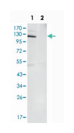 EPHB4, Mouse, Clone: 7H4A6, Abnova 100 &mu;L | Buy Online | Abnova | Fisher Scientific