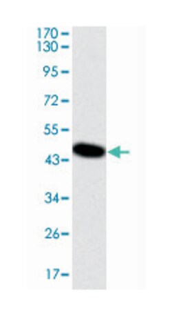 DLK1, Mouse, Clone: 3A10, Abnova 100 &mu;L | Buy Online | Abnova Corporation | Fisher Scientific
