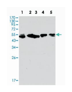 KRT8, Mouse, Clone: 8A5D12, Abnova 100 &mu;L | Buy Online | Abnova | Fisher Scientific