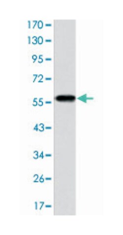 CRKL, Mouse, Clone: 5E12, Abnova 100&mu;L; Unlabeled:Antibodies, Monoclonal
