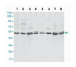 CSK, Mouse, Clone: 5F3, Abnova 100 &mu;L | Buy Online | Abnova | Fisher Scientific