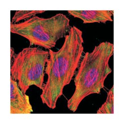 CSK, Mouse, Clone: 5F3, Abnova 100 &mu;L | Buy Online | Abnova | Fisher Scientific