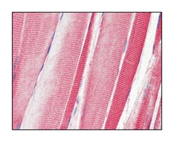 DDR2, Mouse, Clone: 3B11E4, Abnova 100&mu;L; Unlabeled:Antibodies, Monoclonal