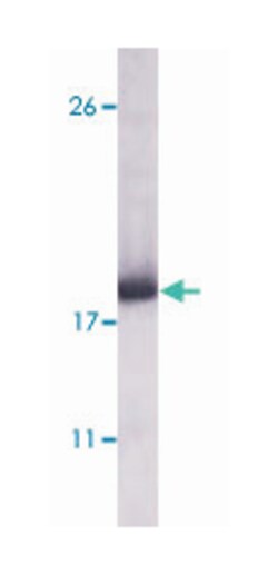 DDR2, Mouse, Clone: 3B11E4, Abnova 100&mu;L; Unlabeled:Antibodies, Monoclonal