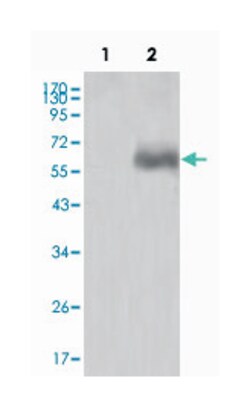DKK1, Mouse, Clone: 2H2, Abnova 100&mu;L; Unlabeled:Antibodies, Monoclonal
