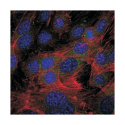 FGG, Mouse, Clone: 4H9, Abnova 100 &mu;L | Buy Online | Abnova Corporation | Fisher Scientific