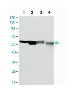 G6PD, Mouse, Clone: 5E12, Abnova 100&mu;L; Unlabeled:Antibodies, Monoclonal