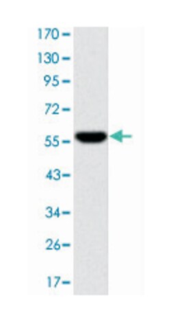 FGG, Mouse, Clone: 4H9, Abnova 100 &mu;L | Buy Online | Abnova Corporation | Fisher Scientific