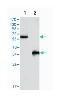 FRK, Mouse, Clone: 4E1, Abnova 100&mu;L; Unlabeled:Antibodies, Monoclonal