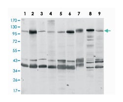 FUK, Mouse, Clone: 6E2, Abnova 100&mu;L; Unlabeled:Antibodies, Monoclonal