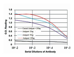 G6PD, Mouse, Clone: 5E12, Abnova 100&mu;L; Unlabeled:Antibodies, Monoclonal