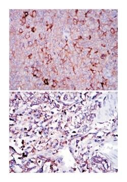 G6PD, Mouse, Clone: 5E12, Abnova 100&mu;L; Unlabeled:Antibodies, Monoclonal