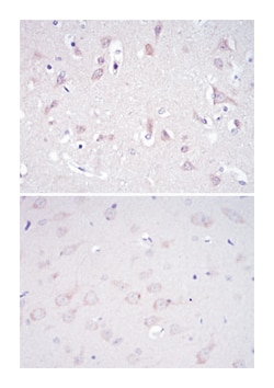 GRIA3, Mouse, Clone: 1D2, Abnova 100&mu;L; Unlabeled:Antibodies, Monoclonal