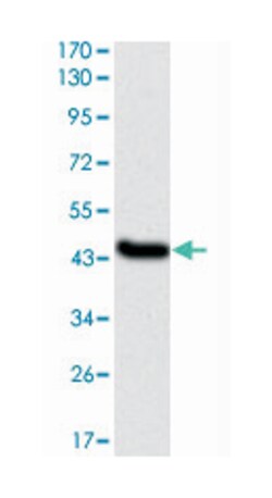 IL1B, Mouse, Clone: 3A6, Abnova 100&mu;L; Unlabeled:Antibodies, Monoclonal