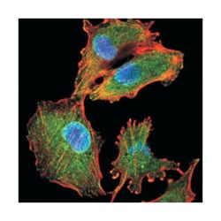 IL34, Mouse, Clone: 1D12, Abnova 100&mu;L; Unlabeled:Antibodies, Monoclonal