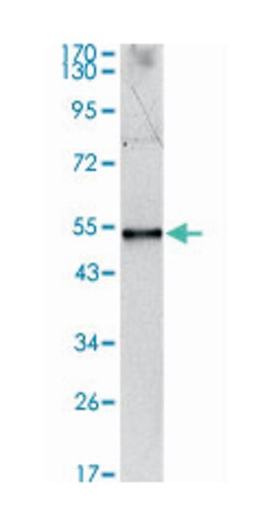 IL34, Mouse, Clone: 1D12, Abnova 100&mu;L; Unlabeled:Antibodies, Monoclonal