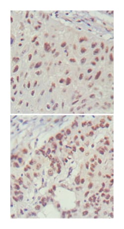 ISL1, Mouse, Clone: 1H9, Abnova 100 &mu;L | Buy Online | Abnova Corporation | Fisher Scientific