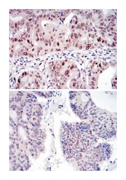 KIF22, Mouse, Clone: 1E3, Abnova 100 &mu;L | Buy Online | Abnova | Fisher Scientific