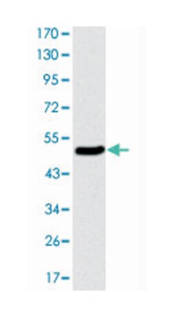 KIF22, Mouse, Clone: 1E3, Abnova 100 &mu;L | Buy Online | Abnova | Fisher Scientific
