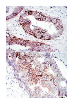 IGF1R, Mouse, Clone: 3G5C1, Abnova 100 &mu;L | Buy Online | Abnova Corporation | Fisher Scientific