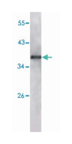IGF1R, Mouse, Clone: 3G5C1, Abnova 100 &mu;L | Buy Online | Abnova Corporation | Fisher Scientific