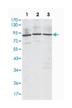IGF2BP3, Mouse, Clone: 8F11, Abnova 100&mu;L; Unlabeled:Antibodies, Monoclonal