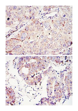 IGF2BP3, Mouse, Clone: 8F11, Abnova 100&mu;L; Unlabeled:Antibodies, Monoclonal