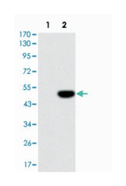 IL1B, Mouse, Clone: 3A6, Abnova 100&mu;L; Unlabeled:Antibodies, Monoclonal