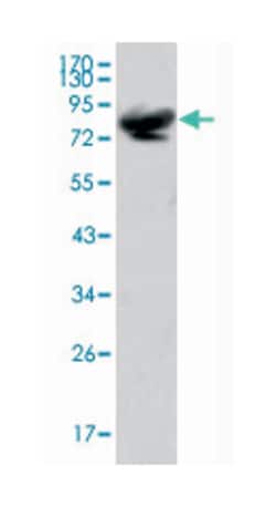 ISL1, Mouse, Clone: 1H9, Abnova 100 &mu;L | Buy Online | Abnova Corporation | Fisher Scientific