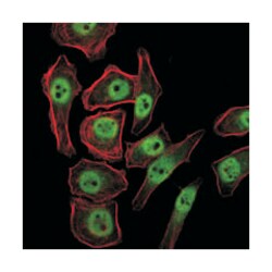JMJD2A, Mouse, Clone: 5H1, Abnova 100&mu;L; Unlabeled:Anticuerpos