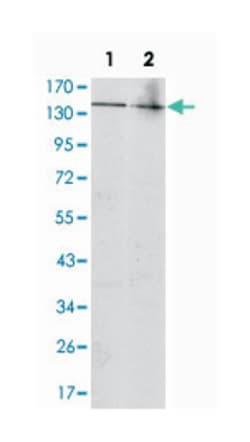 KIT, Mouse, Clone: 1C5, Abnova 100&mu;L; Unlabeled:Antikroppar