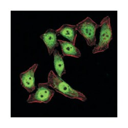 KLF4, Mouse, Clone: 1E6, Abnova 100μL; Unlabeled:Antibodies, Monoclonal