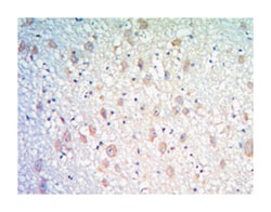 KLHL21, Mouse, Clone: 2H4, Abnova 100&mu;L; Unlabeled:Antibodies, Monoclonal