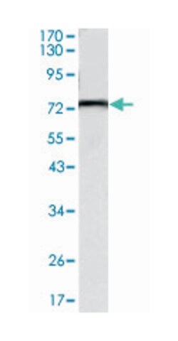 KLHL22, Mouse, Clone: 7B10, Abnova 100 &mu;L | Buy Online | Abnova | Fisher Scientific