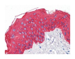 KRT5, Mouse, Clone: 7H8C4, Abnova 100&mu;L; Unlabeled:Antibodies, Monoclonal