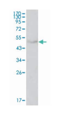 LPL, Mouse, Clone: 2C5, Abnova 100&mu;L; Unlabeled:Antibodies, Monoclonal