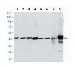 MAPK3, Mouse, Clone: 1E5, Abnova 100&mu;L; Unlabeled:Antibodies, Monoclonal