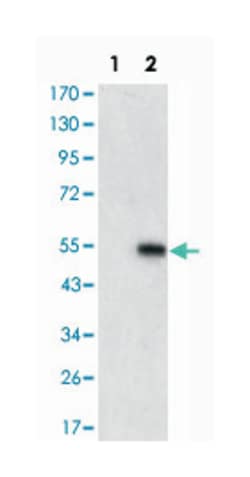 MAPK6, Mouse, Clone: 4E8, Abnova 100&mu;L; Unlabeled:Antibodies, Monoclonal