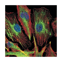 KLHL22, Mouse, Clone: 7B10, Abnova 100 &mu;L | Buy Online | Abnova | Fisher Scientific