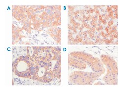 KRT5, Mouse, Clone: 7H8C4, Abnova 100&mu;L; Unlabeled:Antibodies, Monoclonal