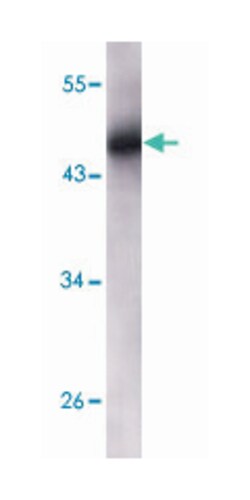 KRT5, Mouse, Clone: 7H8C4, Abnova 100&mu;L; Unlabeled:Antibodies, Monoclonal