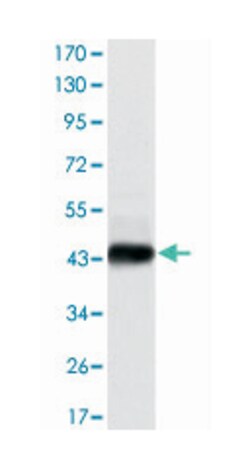 E7, Mouse, Clone: 6F3, Abnova 100&mu;L; Unlabeled:Antibodies, Monoclonal