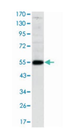 LHX2, Mouse, Clone: 6G2, Abnova 100&mu;L; Unlabeled:Antibodies, Monoclonal