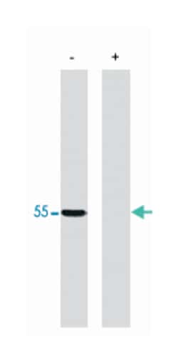 PPP2R2A Rabbit anti-Bovine, Human, Mouse, Rat, Polyclonal Antibody, Abnova 100 &mu;g | Buy Online | Abnova Corporation | Fisher Scientific