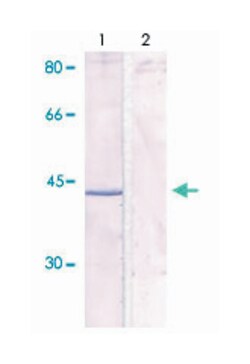 NFKBIA (phospho S32/S36), Rabbit anti-Human, Mouse, Rat, Polyclonal Antibody,
